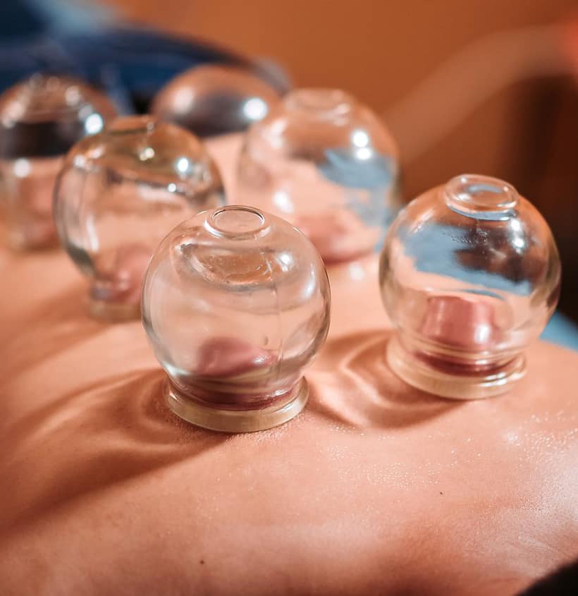 Dry Cupping